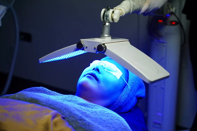 blue laser treatment blue laser treatment