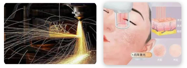 laser application laser application
